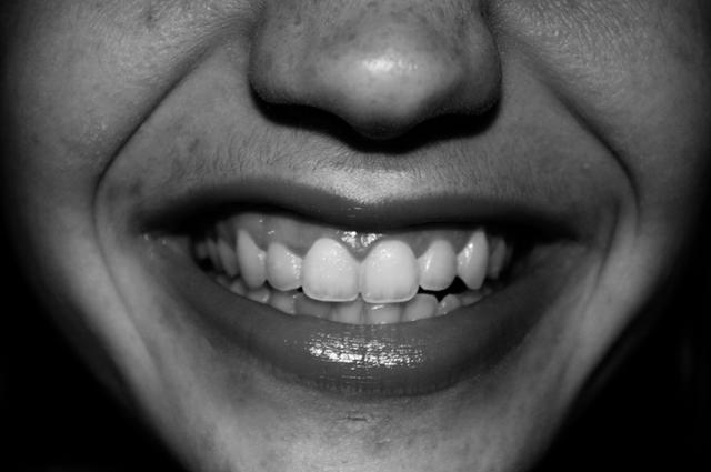 sourire 2