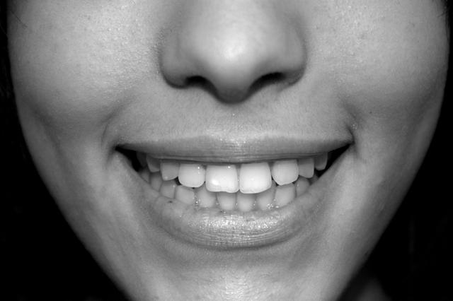 sourire 3